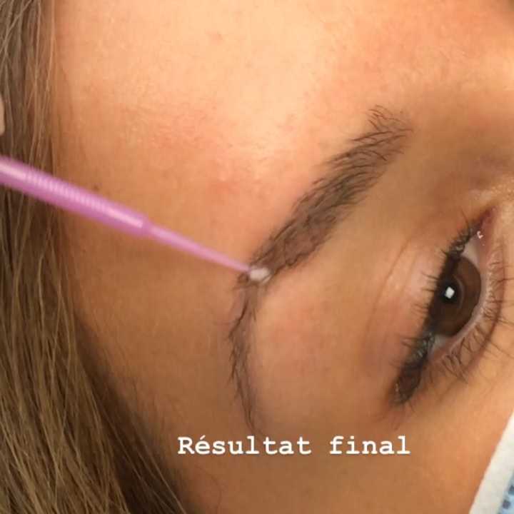 img1